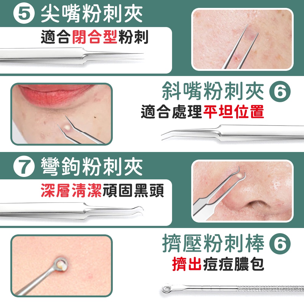 尖嘴粉刺適合閉合型粉刺 彎鉤粉刺夾斜嘴粉刺夾 適合處理平坦位置深層清潔頑固黑頭擠壓粉刺棒6擠出痘痘膿包